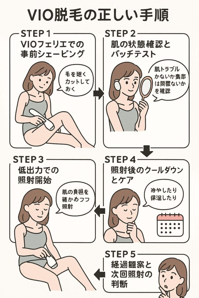 VIO脱毛の正しい手順を示すステップバイステップ図